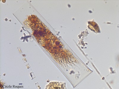 protozoo/Eutintinnus sp (1)(copy)_thumb.jpg